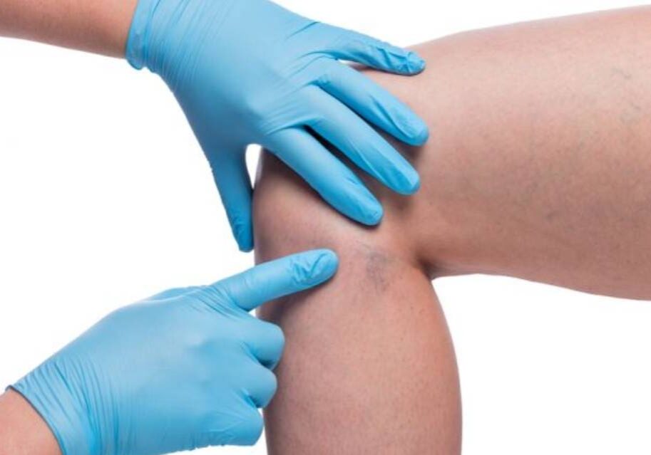 A person with gloves on touching the knee of another person.