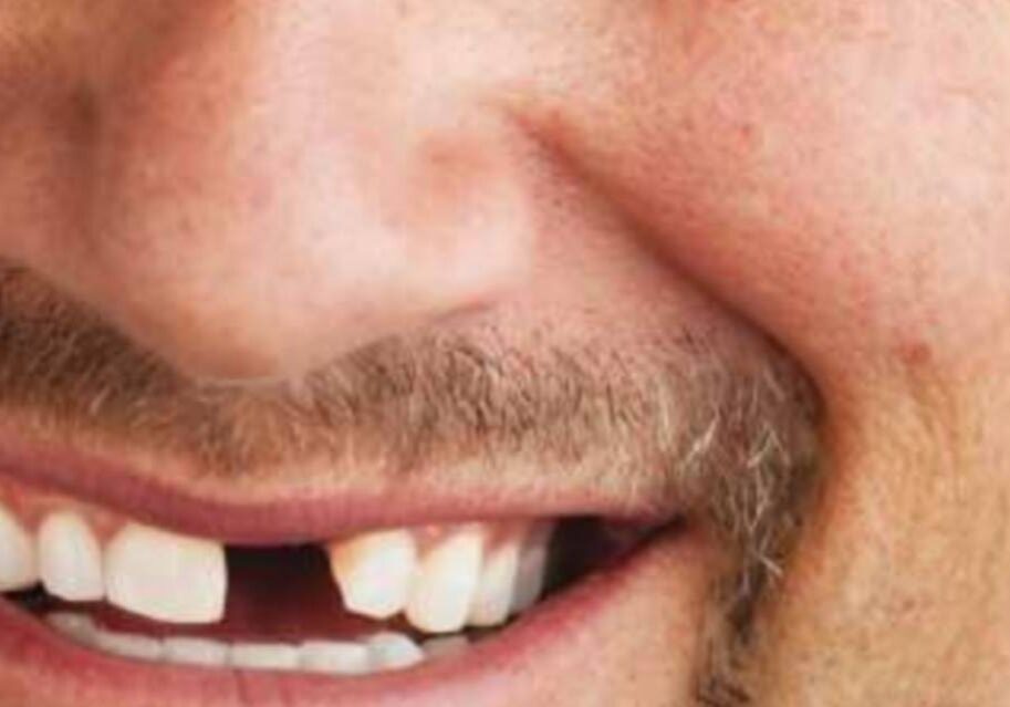 A close up of the teeth and mustache of a man.