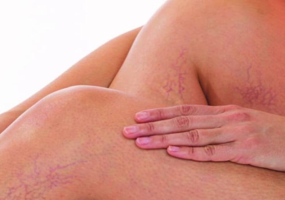 A person with their hands on the back of another person.